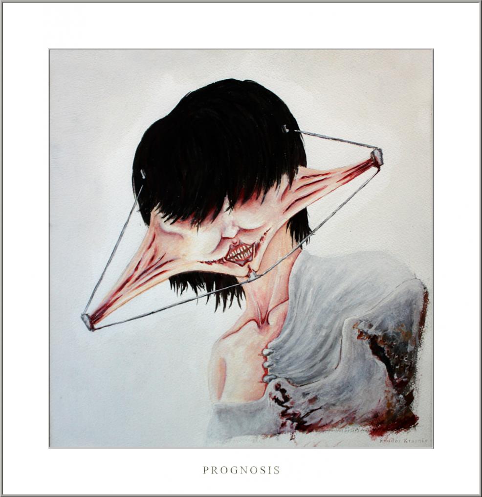 Prognosis