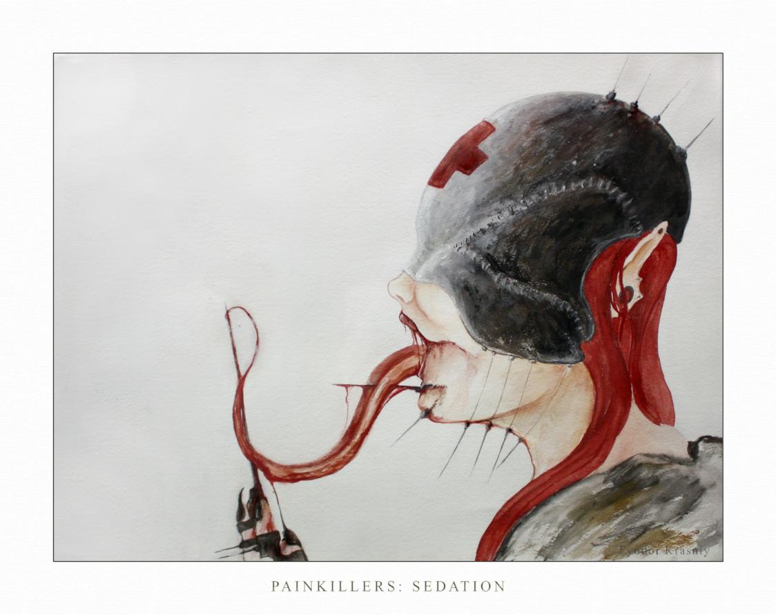 Painkillers - Sedation